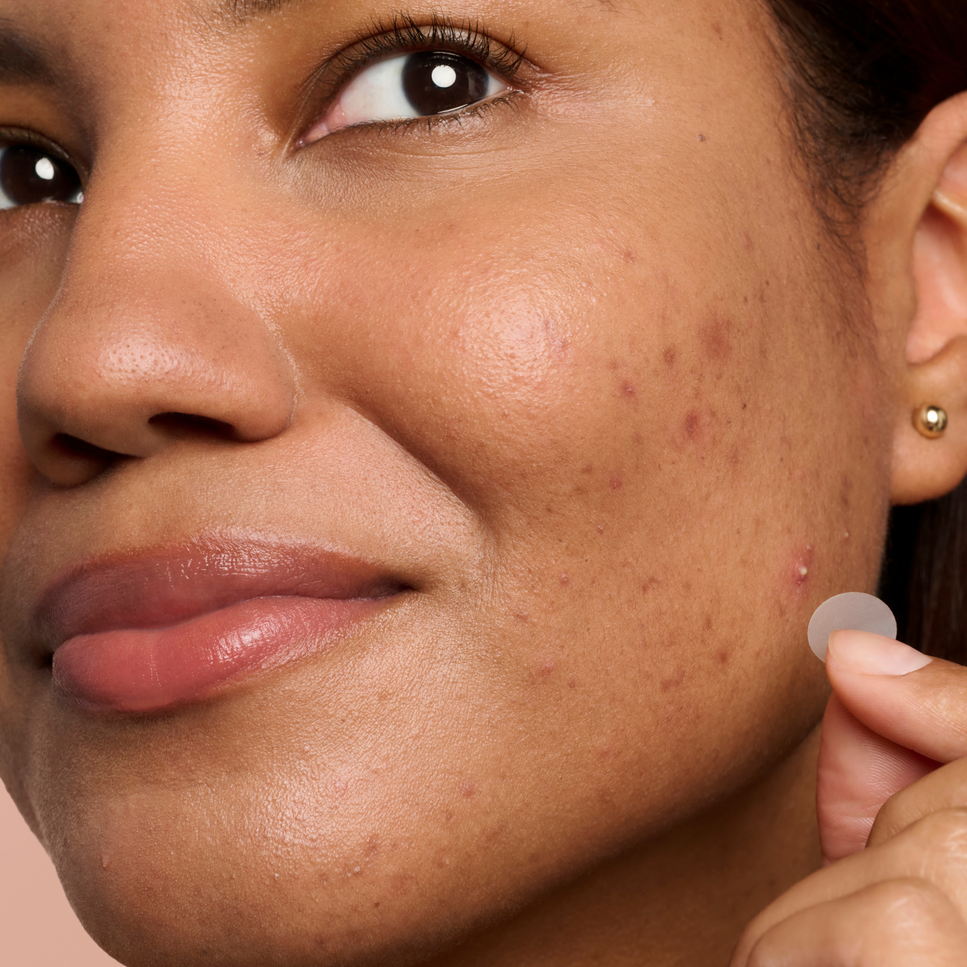 Blemish Control Duo - Gentle Support