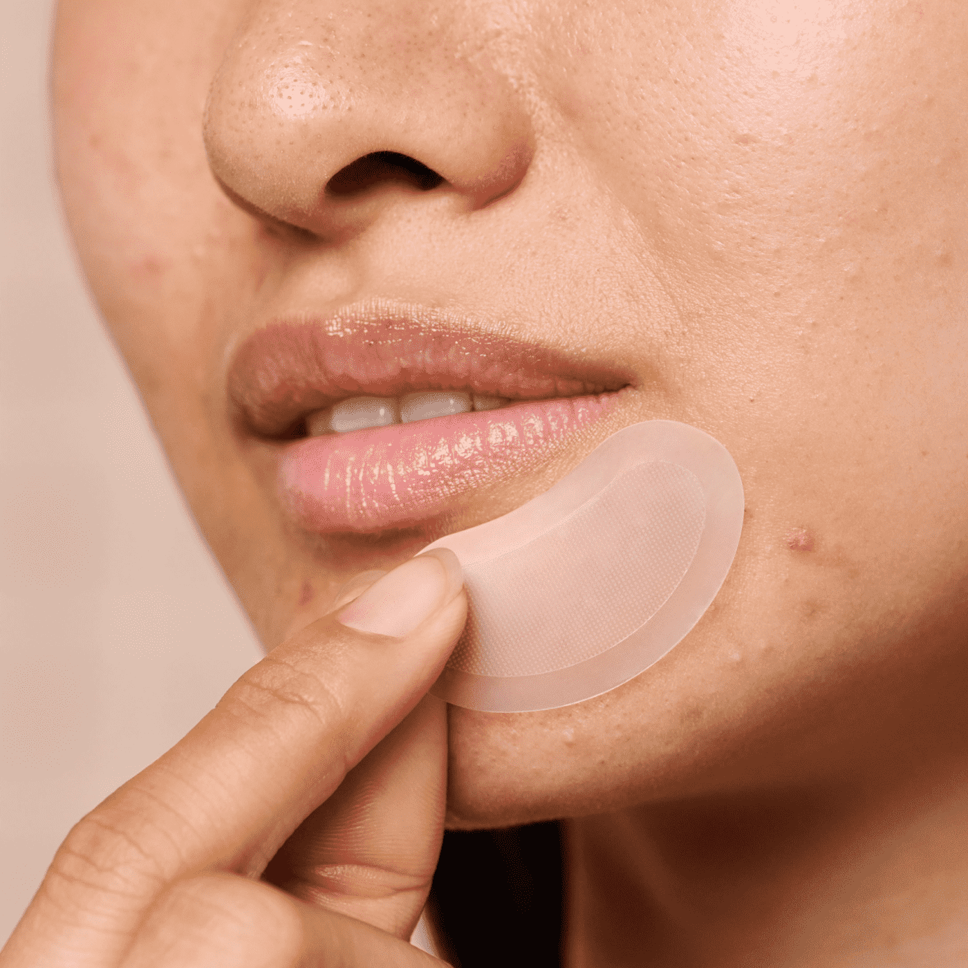 Mighty Patch™ for XL Early-Stage Blemishes - Rapid Start