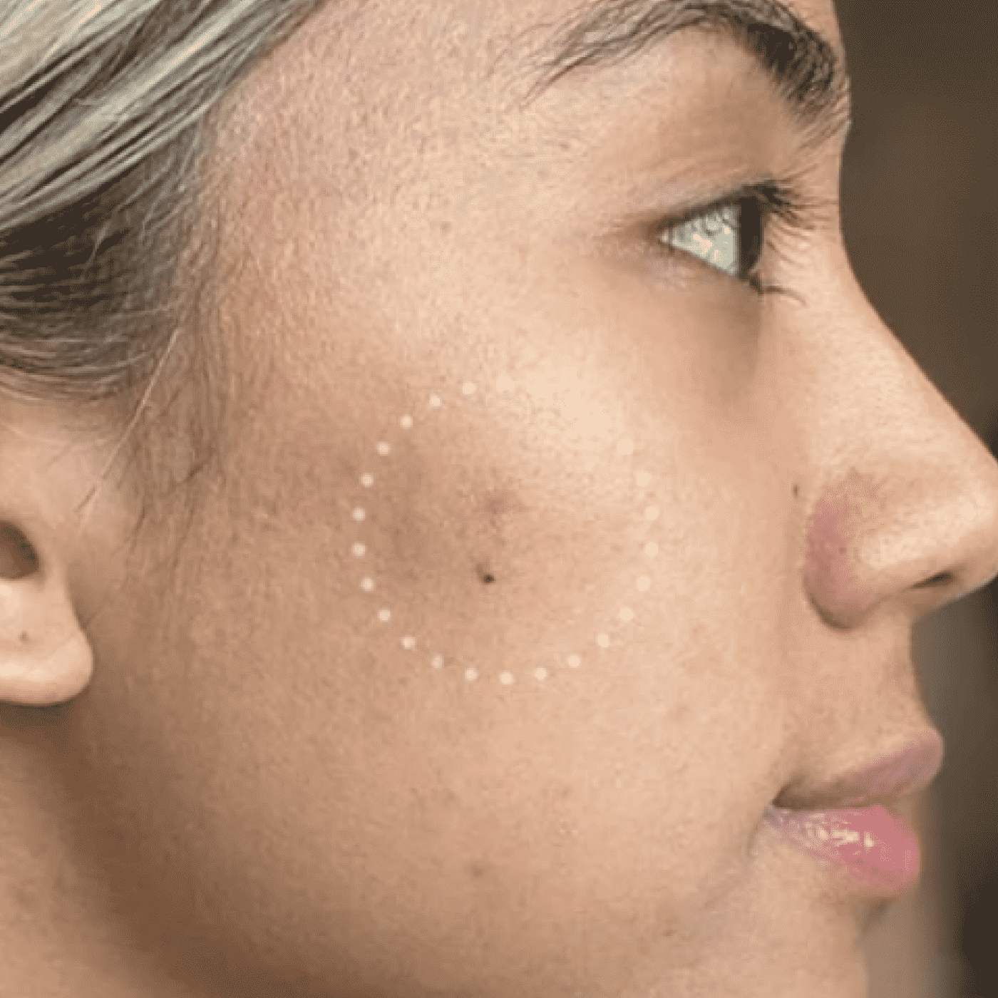 Mighty Patch™ for Dark Spots - Tone Reset