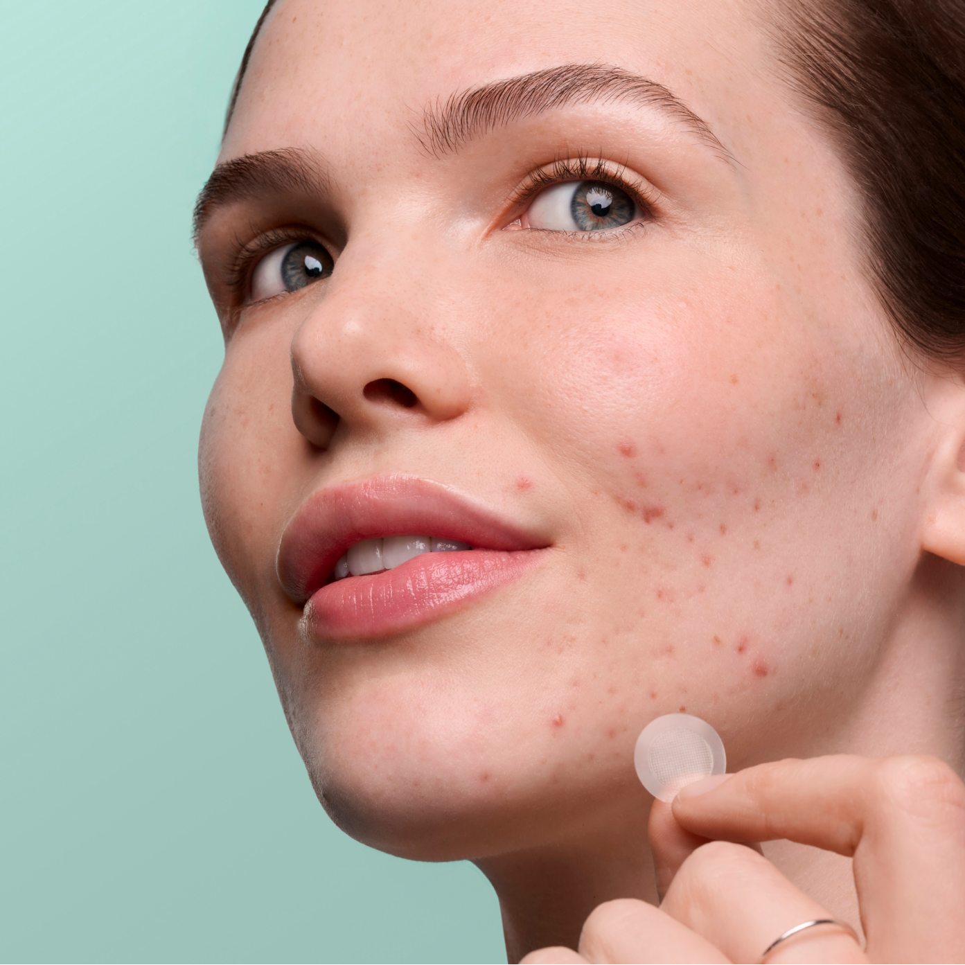 Pimple Patrol Duo - Rapid Relief